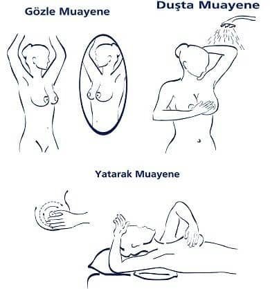 Meme Kanseri Meme Kanseri